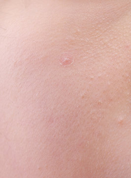 close up view of a human skin (woman face)