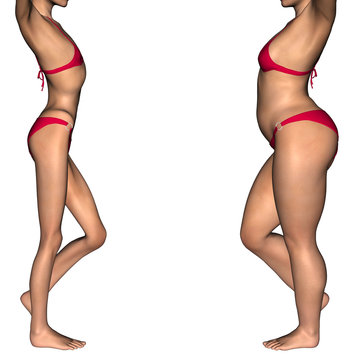 Conceptual 3D woman as fat vs anorexic before and after