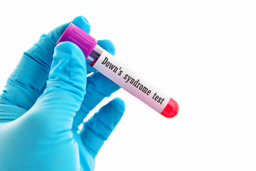 Obraz premium Blood sample for Down's syndrome test 