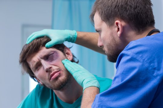 Bruise around the eye
