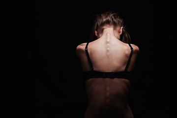 sadness young woman with naked back.sexy body girl - obrazy, fototapety, plakaty