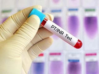 Blood sample for PT/INR test (Blood coagulation testing)

