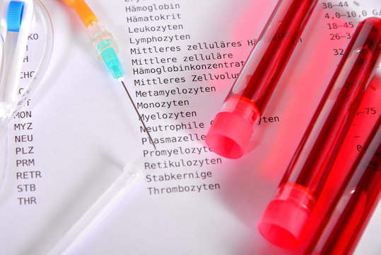 Labor Bluttest Labormedizin Blut