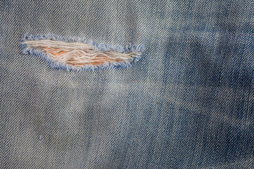 Laceration of jeans.