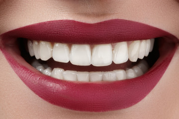 Beautiful smile with whitening teeth. Dental photo. Perfect fashion lips makeup. Health happy female smile. Macro close-up shot of woman's mouth. Care about tooth
