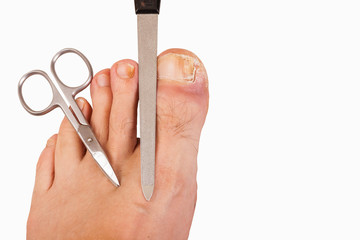 Foot with toenail fungus, scissors and file-isolated