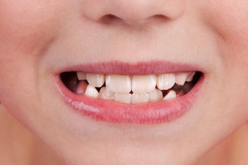 Obraz premium Face of a child with an open mouth and teeth