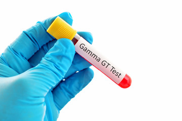 Blood sample for Gamma GT test