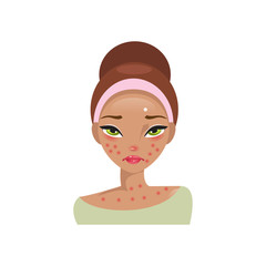 Allergy. Vector Illustration