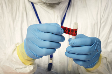 Sealing of plastic tube with DNA collect swab