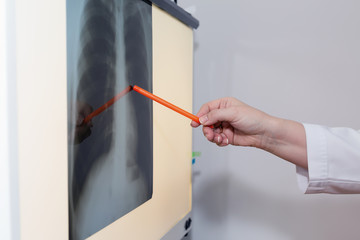 Female doctor examining an x-ray