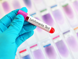 Fototapeta premium Blood sample for Leishmania parasite test