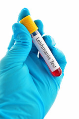 Obraz premium Blood sample for Leishmania parasite test
