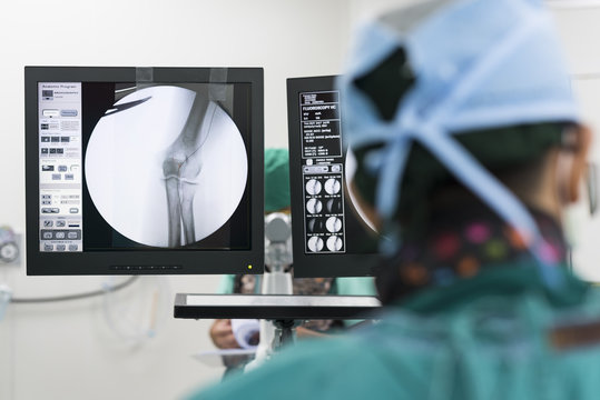 endovascular intervention