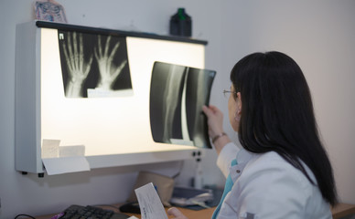 Female doctor examining an x-ray