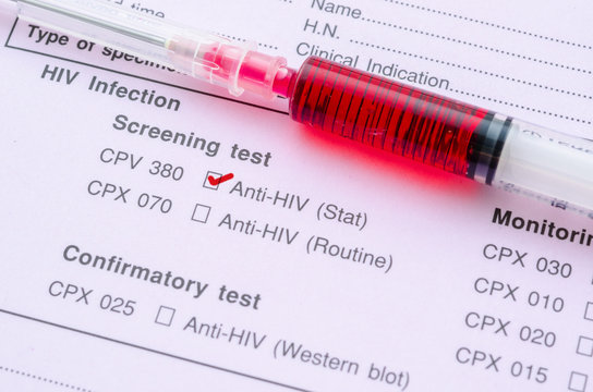 HIV infection screening test form.