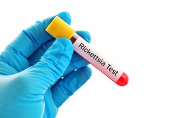 Fototapeta premium Blood for rickettsia test