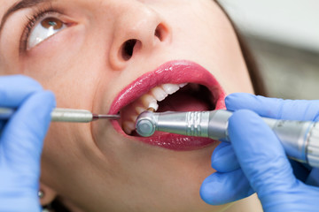 Close-up medical dentist procedure of teeth polish