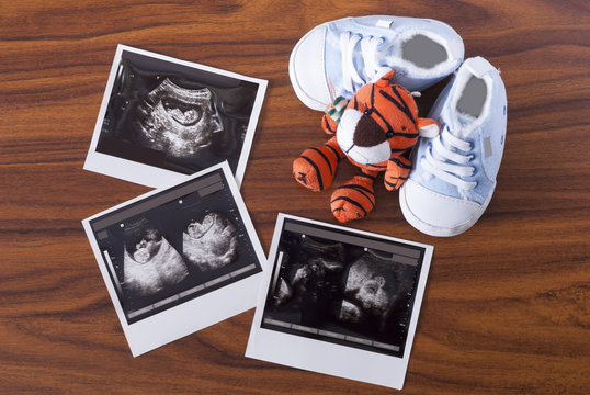 ultrasonography and sneakers
