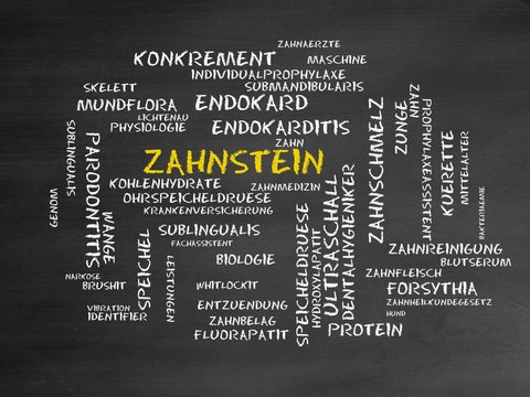 Zahnstein