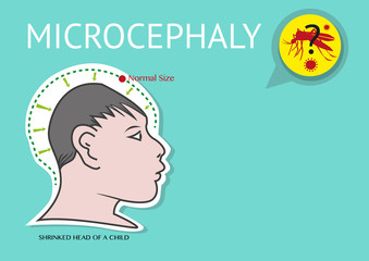 Microcephaly or abnormal smallness of the head linked to Zika Virus 
Zika Virus is suspected to be the cause of microcephaly among women in their first trimester pregnancy