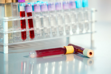 Test tubes - selective focus
