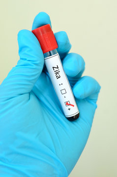 Blood sample positive with Zika virus
