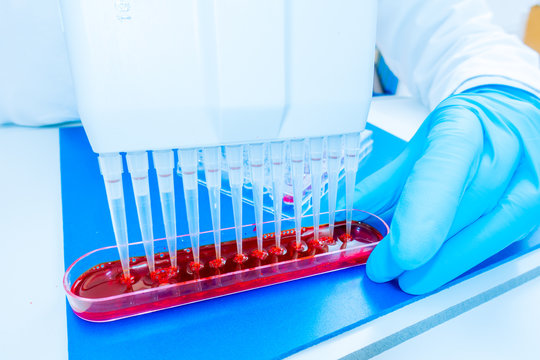 96 well plate for PCR processing, microbiological laboratory