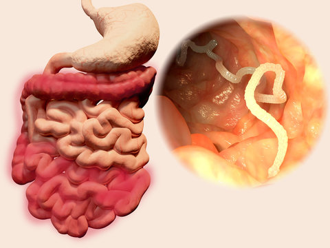 Bandwurm im gastrointestinal Trakt