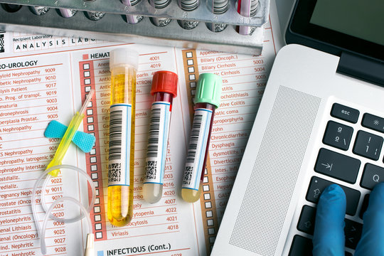 top view of a work table of lab with test tubes for analysis /flat lay of workbench with tubes labeled, laptop and report for blood test