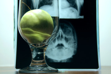 Medical metaphor. Apple in glass over x-ray film of human skull 