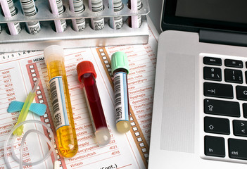 top view of a work table of lab with blood tubes for analysis