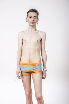 Young man with anorexia nervosa problem.