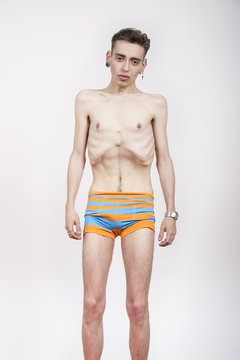 Young man with anorexia nervosa problem.