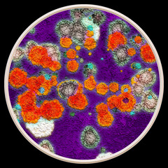 Obraz na płótnie Canvas Lichen and fungi under microscope