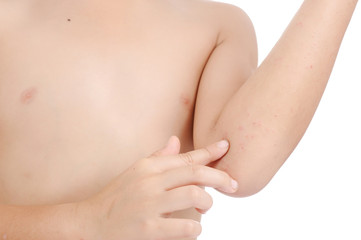 Fototapeta premium Boy wound