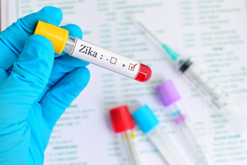 Naklejka premium Blood sample positive with Zika virus