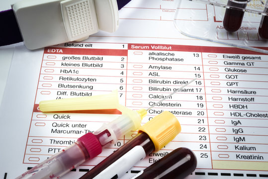 Medizin - Blutproben f&uuml;r eine Untersuchung im Labor