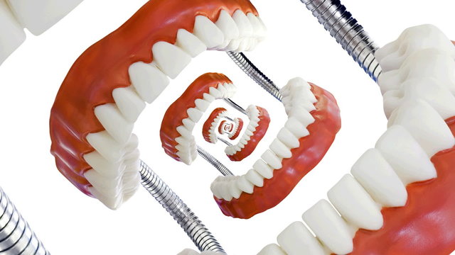 Denture Model Droste Loop Effect