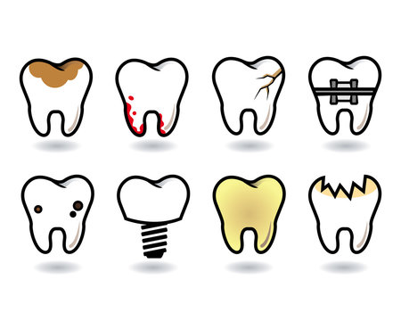 tooth set