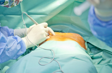 breast augmentation surgery in the operating room surgeon tools implant