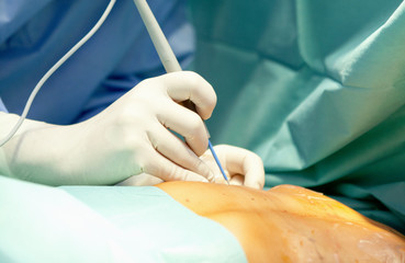 breast augmentation surgery in the operating room surgeon tools implant