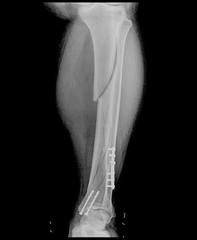 X-ray of the broken leg / Many others X-ray images in my portfolio.