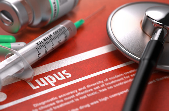 Diagnosis - Lupus. Medical Concept.