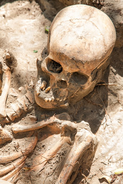 Dug up the skull.