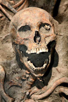 Dug up the skull.