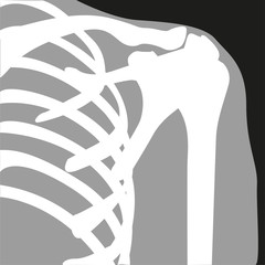 X-ray. Shoulder joint. Symbol. Vector illustration.
