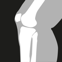 X-ray. Knee-joint. Symbol. Vector illustration.
