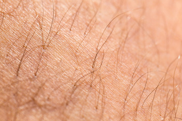detail of human skin with hair