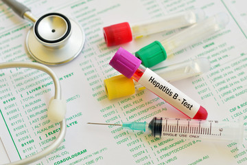 Hepatitis B virus test
